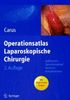 Thomas Carus: Atlas der laparoskop:Carus, Thomas, Buch