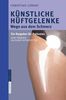 Christian Lüring: Künstliche Hüftgelenke, Buch