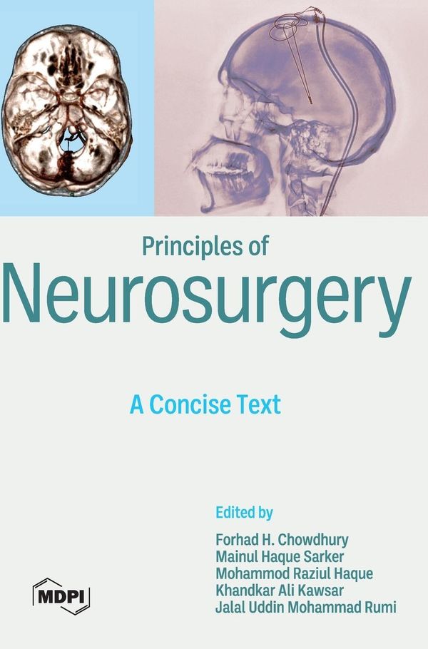 Principles of Neurosurgery