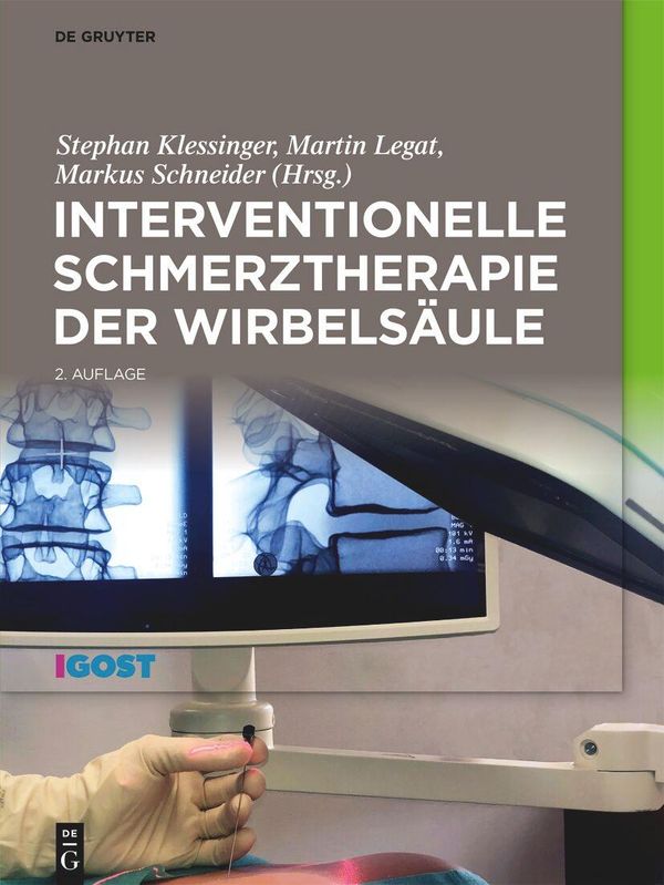 Interventionelle Schmerztherapie der Wirbelsäule (Buch)