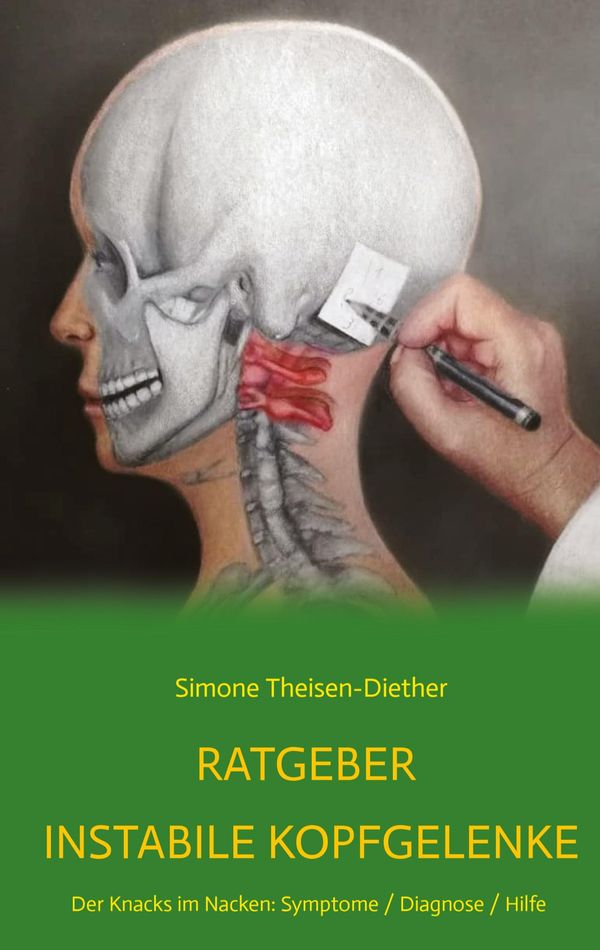 Ratgeber Instabile Kopfgelenke - Simone Theisen-Diether (Buch)