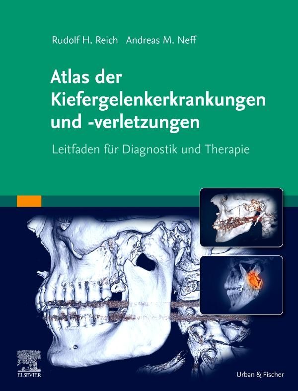 Atlas der Kiefergelenkerkrankungen und -verletzungen - Andreas Neff
