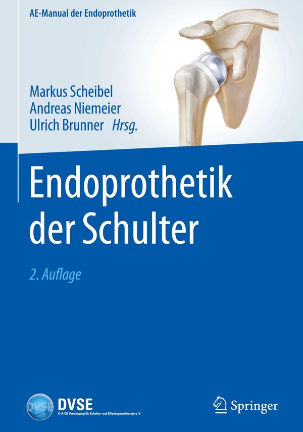 Endoprothetik der Schulter (Buch)