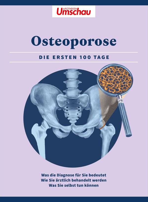 Apotheken Umschau: Osteoporose (Buch)