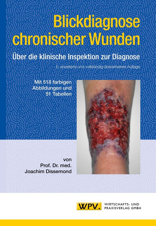 Blickdiagnose chronischer Wunden - Joachim Dissemond (Buch)