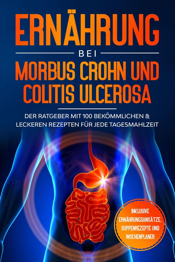 Ernährung bei Morbus Crohn und Colitis Ulcerosa: Der Ratgeber mit 1...